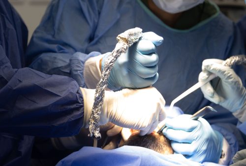 doctors in RWC surgery doing dental implant with live patient course